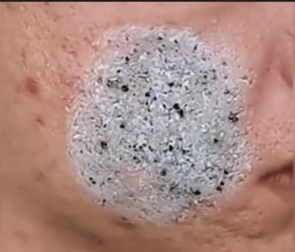 Green Acne Stick – средство для очистки пор
Green Acne Stick – средство для очистки пор