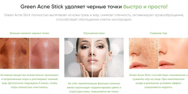 Green Acne Stick – средство для очистки пор
Green Acne Stick – средство для очистки пор
