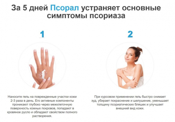 Псорал от псориаза
Псорал от псориаза