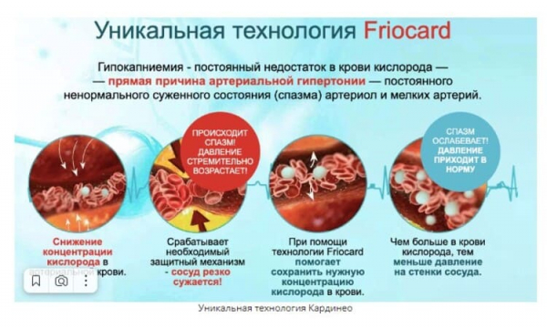 КардиНео средство от гипертонии
КардиНео средство от гипертонии
