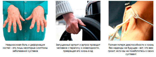 Сустафаст для суставов
Сустафаст для суставов