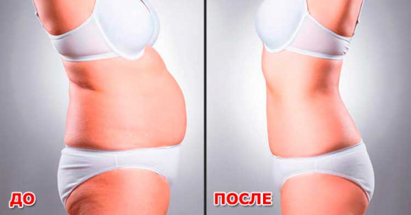 Guarchibao FatCaps для похудения
Guarchibao FatCaps для похудения