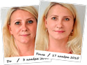 
Collagen для омоложения 