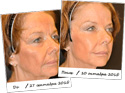 
Collagen для омоложения 