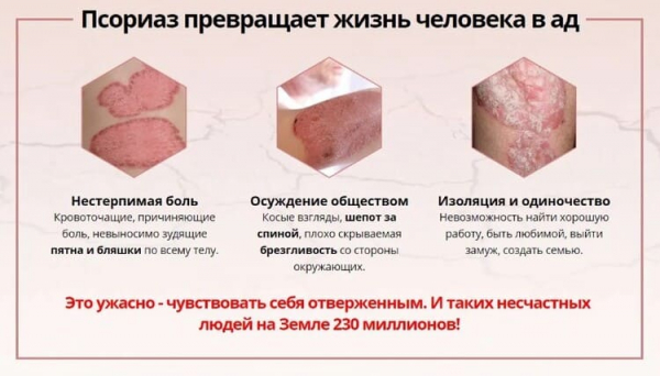 Normaps — средство от псориаза
Normaps — средство от псориаза