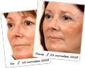 
Collagen для омоложения 