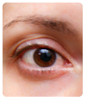 OptiDuo
OptiDuo