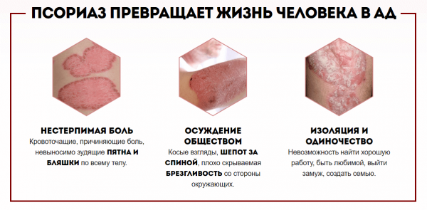 Оптидермал от псориаза
Оптидермал от псориаза