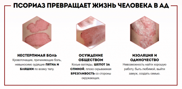 
Оптидермал от псориаза 