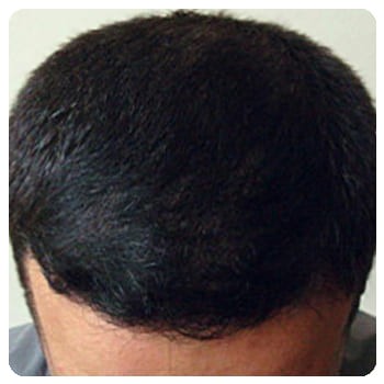 VIHAIR для роста волос. КУПИТЬ сыворотку, отзывы, цена в России? VIHAIR для роста волос. КУПИТЬ сыворотку, отзывы, цена в России?