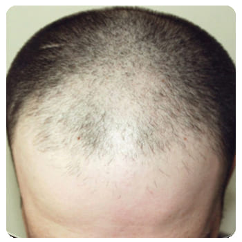 VIHAIR для роста волос. КУПИТЬ сыворотку, отзывы, цена в России? VIHAIR для роста волос. КУПИТЬ сыворотку, отзывы, цена в России?