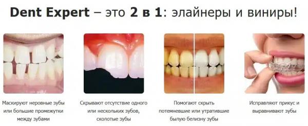 Dent Expert виниры для зубов
Dent Expert виниры для зубов