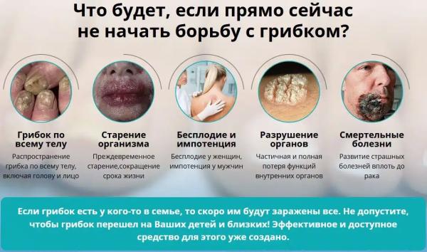 
				Варанга &mdash; крем от грибка			