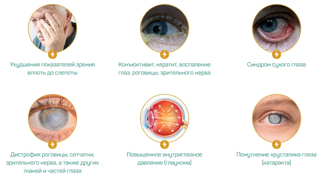 БиОкулист (BiOculist) — инновационный комплекс для восстановления и защиты зрения: купить в России БиОкулист (BiOculist) — инновационный комплекс для восстановления и защиты зрения: купить в России