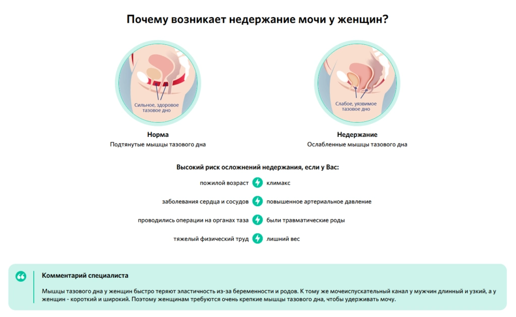 Урофарм для женщин — капсулы от недержания мочи: купить в России Урофарм для женщин — капсулы от недержания мочи: купить в России