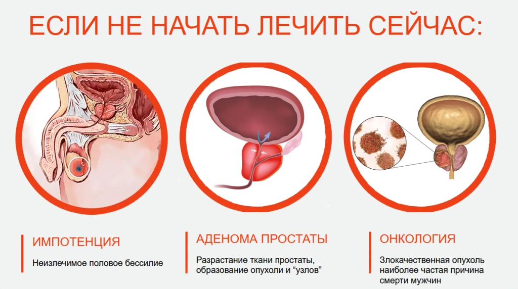 Урофарм для мужчин — капсулы от простатита: купить в России