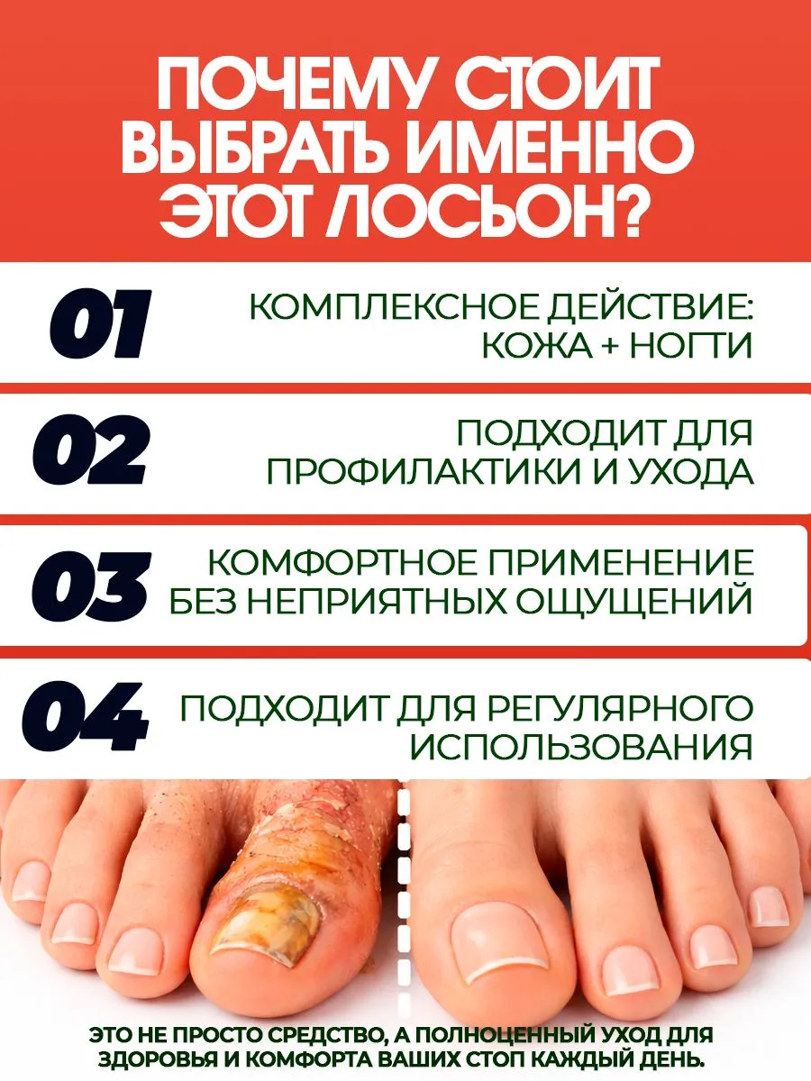 Живоуст (Живой Уст) — масло лабазника для борьбы с грибком кожи и ногтей