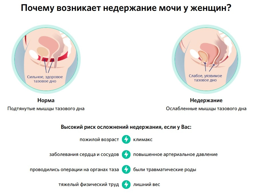 Стопинор для женщин (Stopinor) — от недержания мочи: купить в России Стопинор для женщин (Stopinor) — от недержания мочи: купить в России