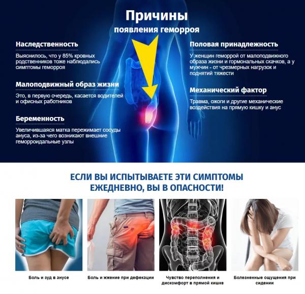 Proctovenol — крем от геморроя в России
Proctovenol — крем от геморроя в России